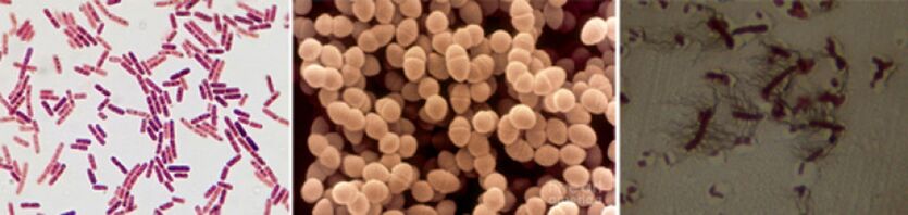Escherichia coli, Enterococcus faecalis and Proteus are the main pathogens of chronic bacterial prostatitis